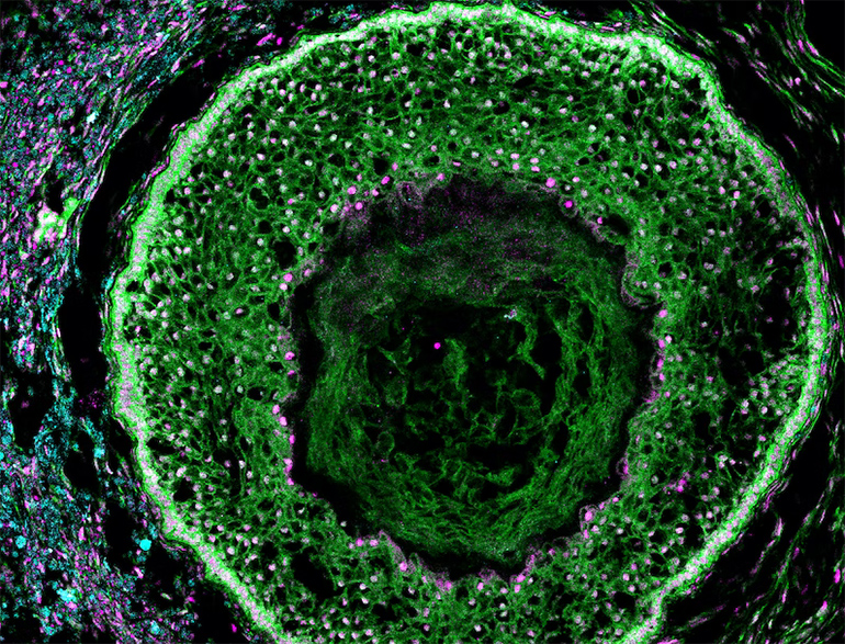 MESH Incubator™ at Mass General Brigham (@meshincubator) on Twitter photo Ovarian Organoids to Study Reproductive Health: Researchers at the Harvard Wyss Institute are collaborating with a biotechnology company called Gameto to develop human ovarian organoids that will allow the study of reproductive and… dlvr.it/Sk8YZp @medgadget <a href="/medtech/">Patsy Bentley Hall</a> Ovarian Organoids to Study Reproductive Health: Researchers at the Harvard Wyss Institute are collaborating with a biotechnology company called Gameto to develop human ovarian organoids that will allow the study of reproductive and… dlvr.it/Sk8YZp @medgadget <a href="/medtech/">Patsy Bentley Hall</a>