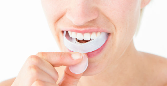 Raganortho's tweet photo. Proper #MouthGuards are needed to protect athletes in a variety of sports. https://t.co/zB7XrPUvqT https://t.co/YAv8UasGPK