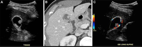 RadioGraphics_Editor tweet media