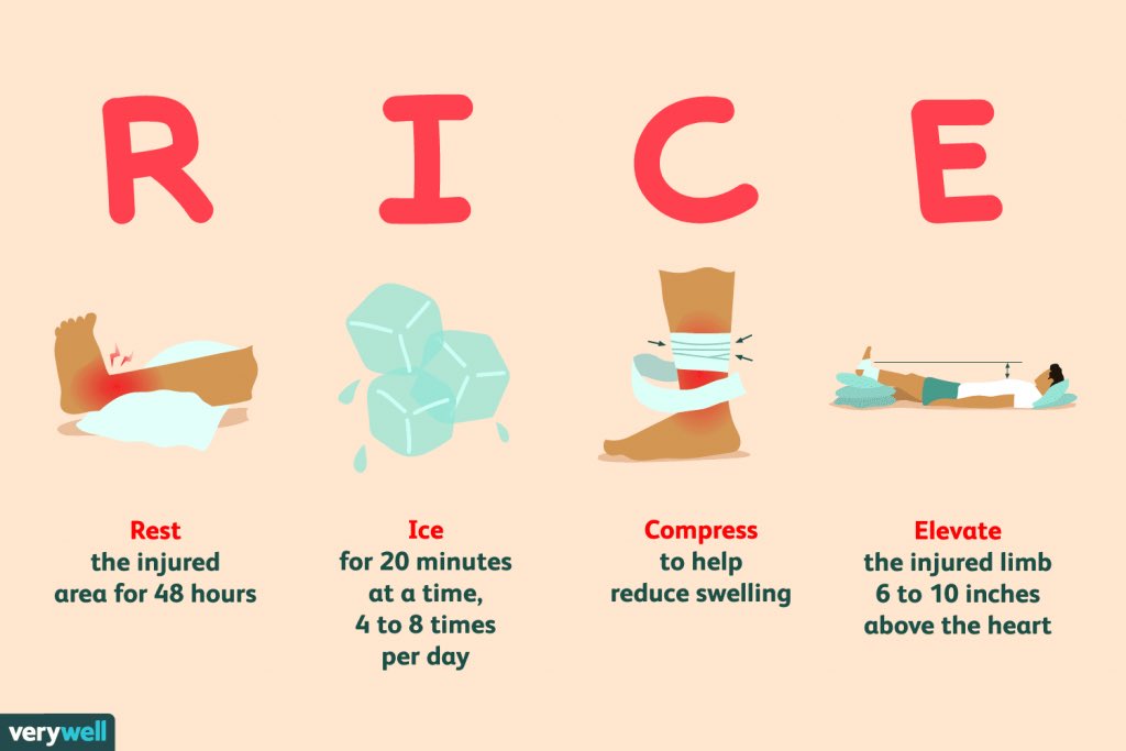 JMeyrelesWISE's tweet photo. For many years athletes have been told to follow the RICE method for acute injuries. Recently, there has been limited research to prove that ice actually helps the healing process. You can read more here ➡️
https://t.co/BpN9ehAHWk. #WISE2023 #athletictraining @YHSMrsMero https://t.co/XWGqN1bEaz