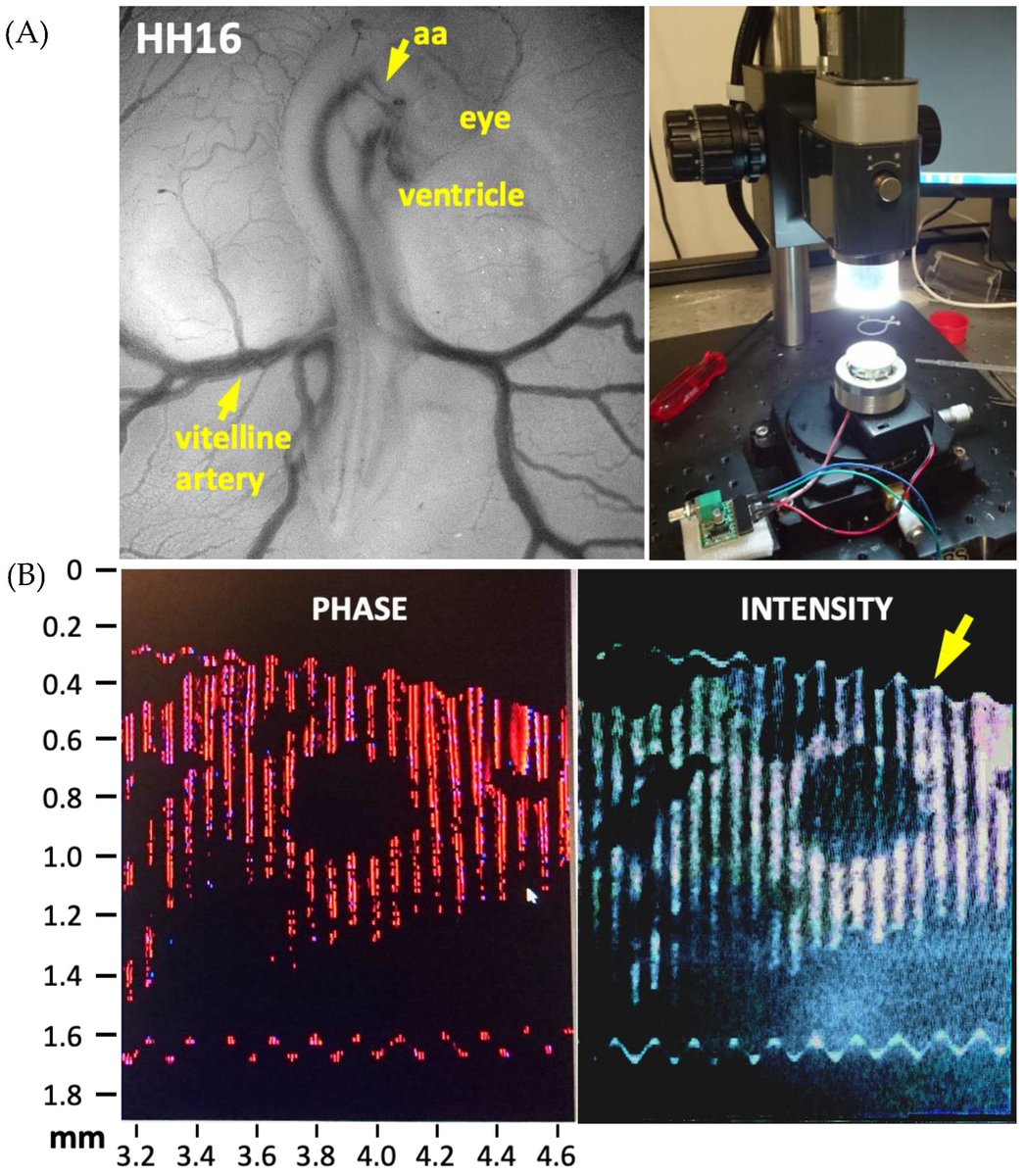 JCDD_MDPI's tweet photo. #jcdd #RecommendedPaper
"#SoftTissueMaterial Properties and Mechanogenetics during #CardiovascularDevelopment" https://t.co/c1TQJ3RhdU
#cardiovascularmicrostructure #congenitalheartdefects #chickembryo #cardiovascularsystem #hemodynamics #arterialpressure #embryonicheart https://t.co/M336VUrCMD