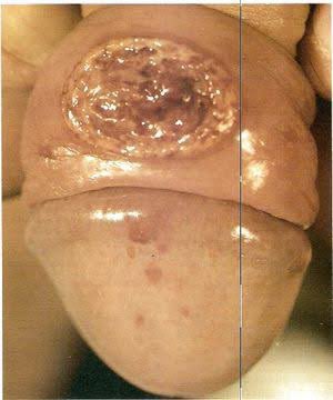 In order to strike a balance in terms of health information delivery

This is a thread showing commo...