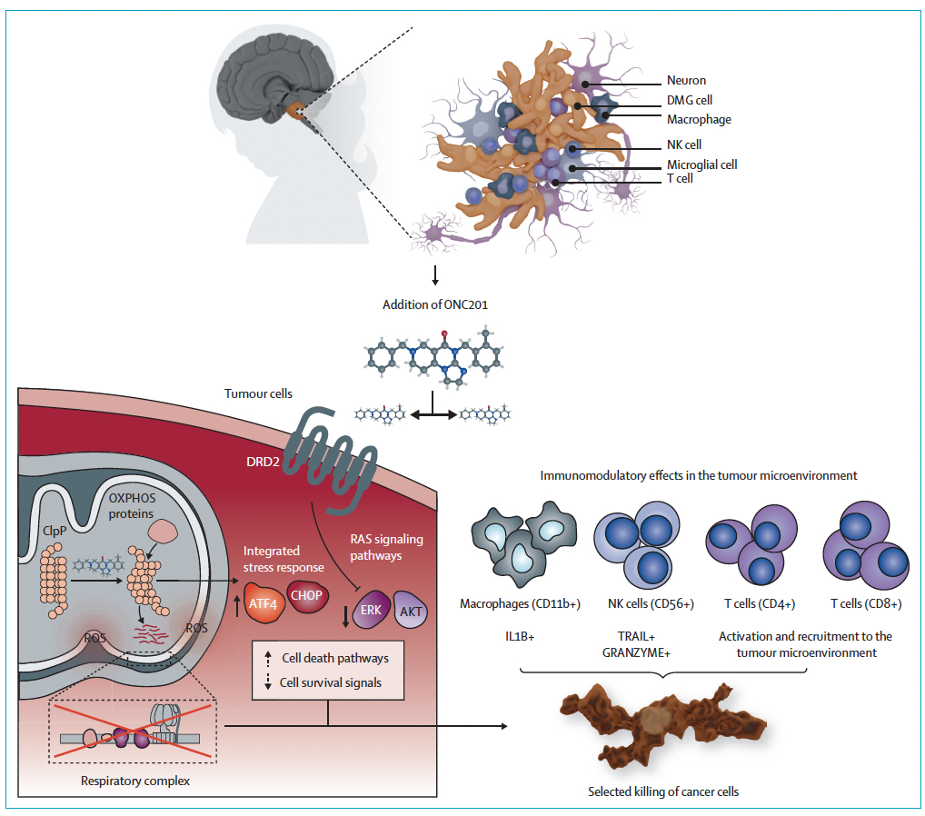 Luis Moreno Sánchez (@radioncoluis) on Twitter photo Access to new drugs in paediatric oncology: can we learn from the ongoing ONC201 saga?.
thelancet.com/journals/lanon…
<a href="/WendyGomez1980/">Wendy Gomez García</a> <a href="/margaritaimd/">margaritamonterodiaz</a> <a href="/isabeldionicio3/">isabeldionicio101@hotmail.com</a> Crismely Moya Leyri Jorge Máxima Pichardo Access to new drugs in paediatric oncology: can we learn from the ongoing ONC201 saga?.
thelancet.com/journals/lanon…
<a href="/WendyGomez1980/">Wendy Gomez García</a> <a href="/margaritaimd/">margaritamonterodiaz</a> <a href="/isabeldionicio3/">isabeldionicio101@hotmail.com</a> Crismely Moya Leyri Jorge Máxima Pichardo