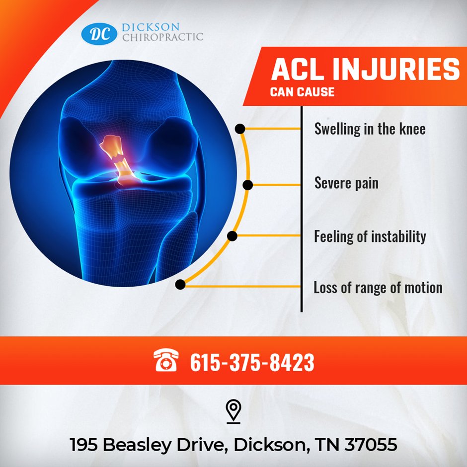 D_Chiropractic's tweet photo. Leg injuries are pretty common when playing high-contact sports. An Anterior Cruciate Ligament (ACL) injury can cause swelling and instability in your knees. Learn how we can help https://t.co/dfUX8QMzQR

#ACL #aclinjuries #pian #swelling #sportsinjury https://t.co/xIgNzBE50Z