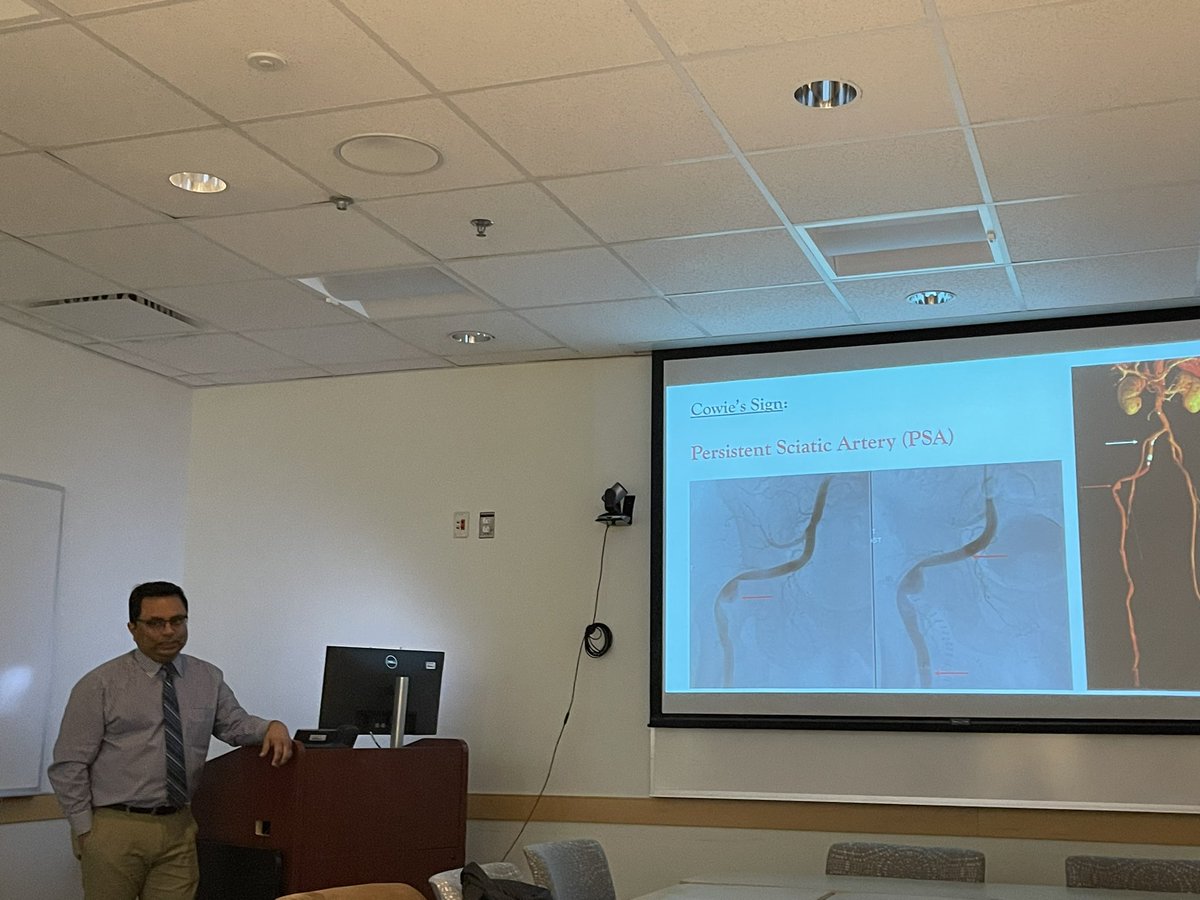 Learning about Persistent Sciatic Artery with <a href="/GParmar_MD/">Gaurav Parmar</a>!! <a href="/IhsanKaadanMD/">Ihsan Kaadan, MD, MS</a> <a href="/Angiologist/">Ido Weinberg, MD</a> @mgh