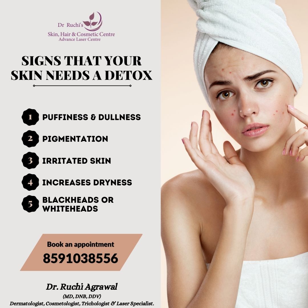 Signs that your skin needs a detox...
 #blackheads #mumbaiwedding #bridetobe #dullskin #bodypolish #girl #acnetreatments #weddingspecial #kandivaliwest #special #whiteheads #rejuvenate #darkcircles #healthy #food #mumbaiblogger #medifacial #kandivalieast #laserfacial #kandivali