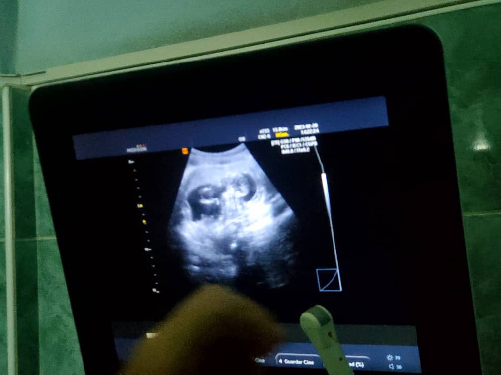 Dios mío permite que esta pequeña cosita q viene en camino ....llegue de la forma más linda q pueda existir....
la alegria más grande de una madre 👩‍👧comienza cuando una nueva vida se agita en su interior .... 🤗🤗🤗