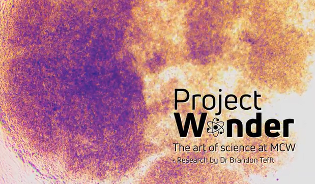 Excited to see the beauty of Dr. Brandon Tefft's #CardiovascularRegenerativeEngineering research come to life in the form of art during #ProjectWonder. This is a don't-miss exhibit running 2/10-3/12 at #NorthwesternMutual Art Gallery at 
@stritchu More: mcw.edu/project-wonder…