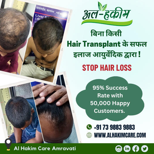 Best hair loss treatment for male & female both. Get Proven Hair Treatment. Book Appointment Now. 
Al Hakim Hijama And Ayurvedic In Amravati
Call :- 73 9883 9883
Address :- Al Badar Complex, Walgaon Rd, Amravati, Maharashtra 444601
#hairfallsolution #hairfalltreatment