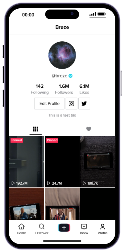 Breze_v's tweet photo. TikTok is shortly coming to the phone! https://t.co/aQd3RkWDYg