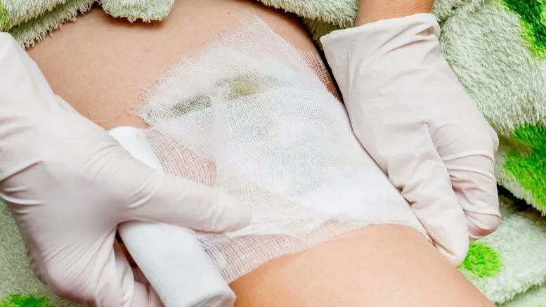 Journal of mHealth (@journal_mhealth) on Twitter photo A Wound Care Study: Has the Pandemic Led to New and Improved Ways of Working? 
buff.ly/3ED37Z0 
#woundcare #innovation #medtech #healthtech #technology #digitalhealth #healthcare #medical #digitalhealthnews <a href="/SkyMedTech/">Sky Medical Technology</a> A Wound Care Study: Has the Pandemic Led to New and Improved Ways of Working? 
buff.ly/3ED37Z0 
#woundcare #innovation #medtech #healthtech #technology #digitalhealth #healthcare #medical #digitalhealthnews <a href="/SkyMedTech/">Sky Medical Technology</a>