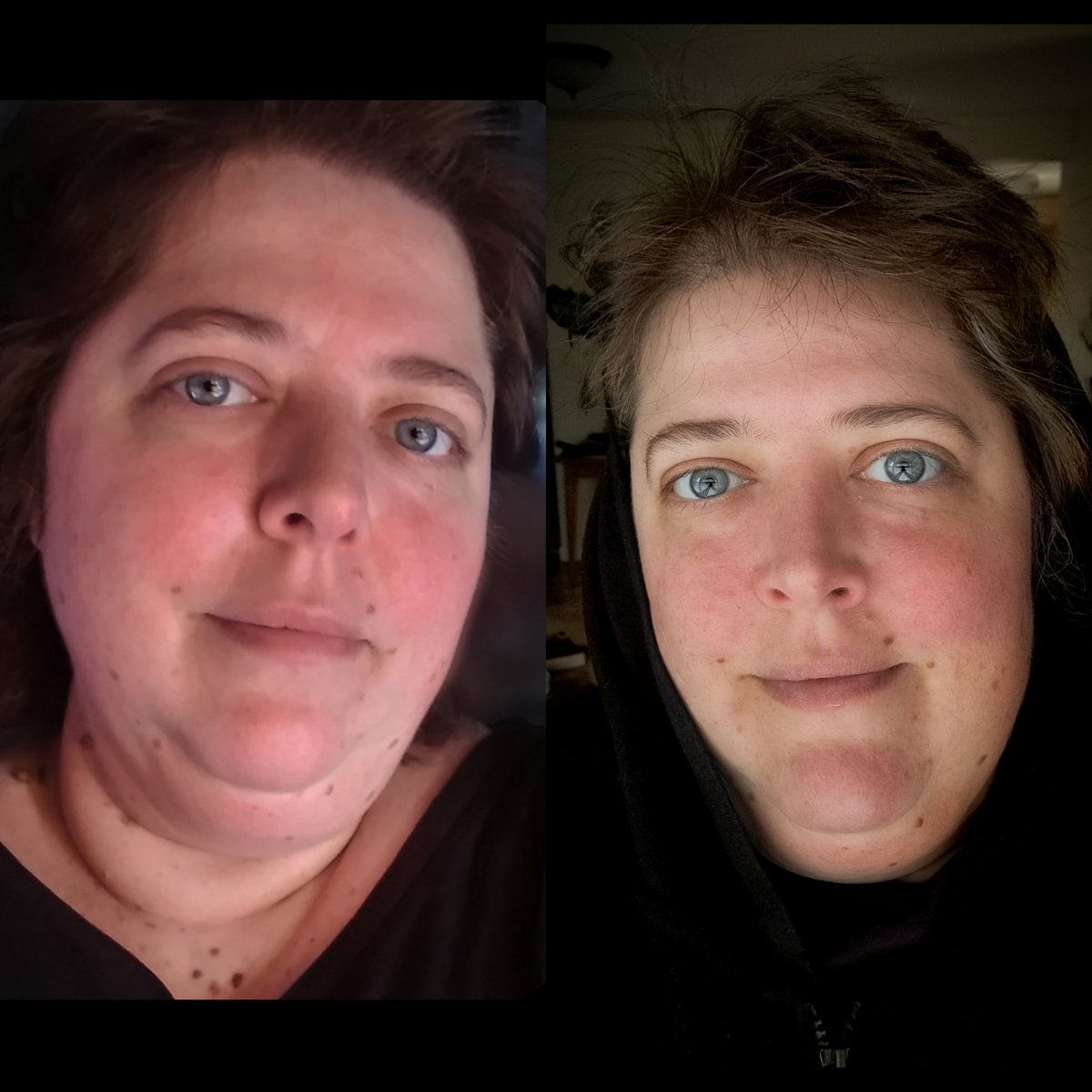 356 days sober...
9 days away from my 1st full year alcohol free
The left photo was day 1. The right photo is today.
#RecoveryPosse #odaat #sobriety #boozefree #noalcohol #formeralcoholic #soberlife