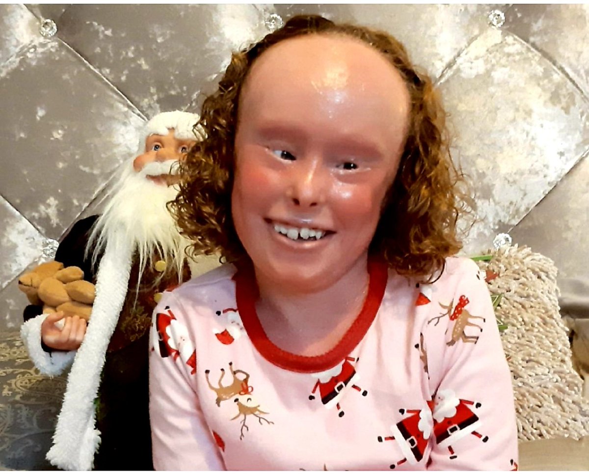 CARLEENWALGAL's tweet image. 🧸A mum&apos;s special request🧸
All children learn taught behaviours. By saying hello,smiling, admiring a funky outfit or set of wheelchair chair covers, you set a positive example. Trust me, little hearts will swell with pride &amp;amp; big hearts with gratitude #RareDiseaseDay #ichthyosis