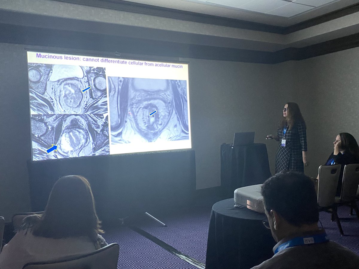 David D.B. Bates (@davidbatesmd) on Twitter photo Great talk on “Watch and Wait” approach in rectal cancer after total neoadjuvant therapy by <a href="/Iva_Petkovska_5/">Iva Petkovska MD FSAR</a> and Jenn Golia Pernicka at #SAR23
<a href="/SARDFPRECTAL/">SAR_DFP_RECTALANAL</a> <a href="/CYOC_MSK/">MSKCC's Center for Young Onset Colorectal Cancer</a> <a href="/MSKCancerCenter/">Memorial Sloan Kettering Cancer Center</a> Great talk on “Watch and Wait” approach in rectal cancer after total neoadjuvant therapy by <a href="/Iva_Petkovska_5/">Iva Petkovska MD FSAR</a> and Jenn Golia Pernicka at #SAR23
<a href="/SARDFPRECTAL/">SAR_DFP_RECTALANAL</a> <a href="/CYOC_MSK/">MSKCC's Center for Young Onset Colorectal Cancer</a> <a href="/MSKCancerCenter/">Memorial Sloan Kettering Cancer Center</a>
