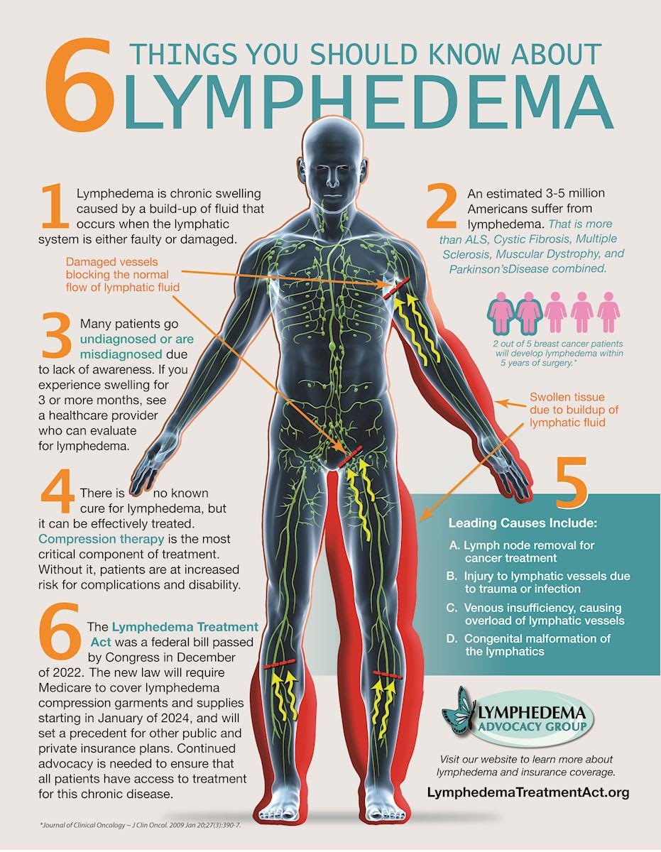 LymphedemaAct's tweet photo. Happy #Lymphedema Awareness Month!

To help you spread awareness about lymphedema and the upcoming improvements to insurance coverage thanks to passage of the #LymphedemaTreatmentAct, we have an updated flyer (seen below) that you can download for free. https://t.co/hzHuwvDvCM https://t.co/C8WwaBuojD