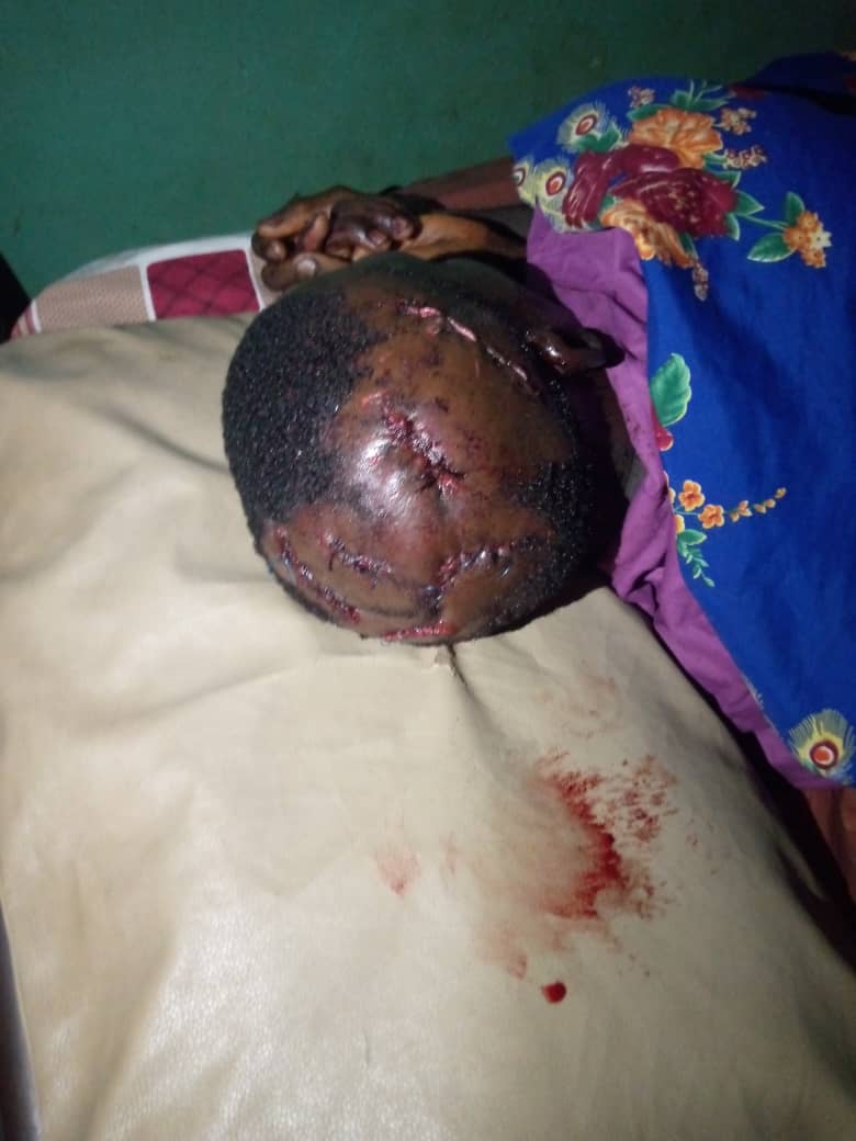 Ondoeyee's tweet photo. Farmers in Akure North LGA of Ondo state have cried out to Governor @RotimiAkeredolu over the incessant attacks on them by suspected herdsmen. 

They said one of them was attacked with a matchet &amp; sustained injuries, saying the victim he's now receiving treatment in the hospital. https://t.co/GjAaclGl20