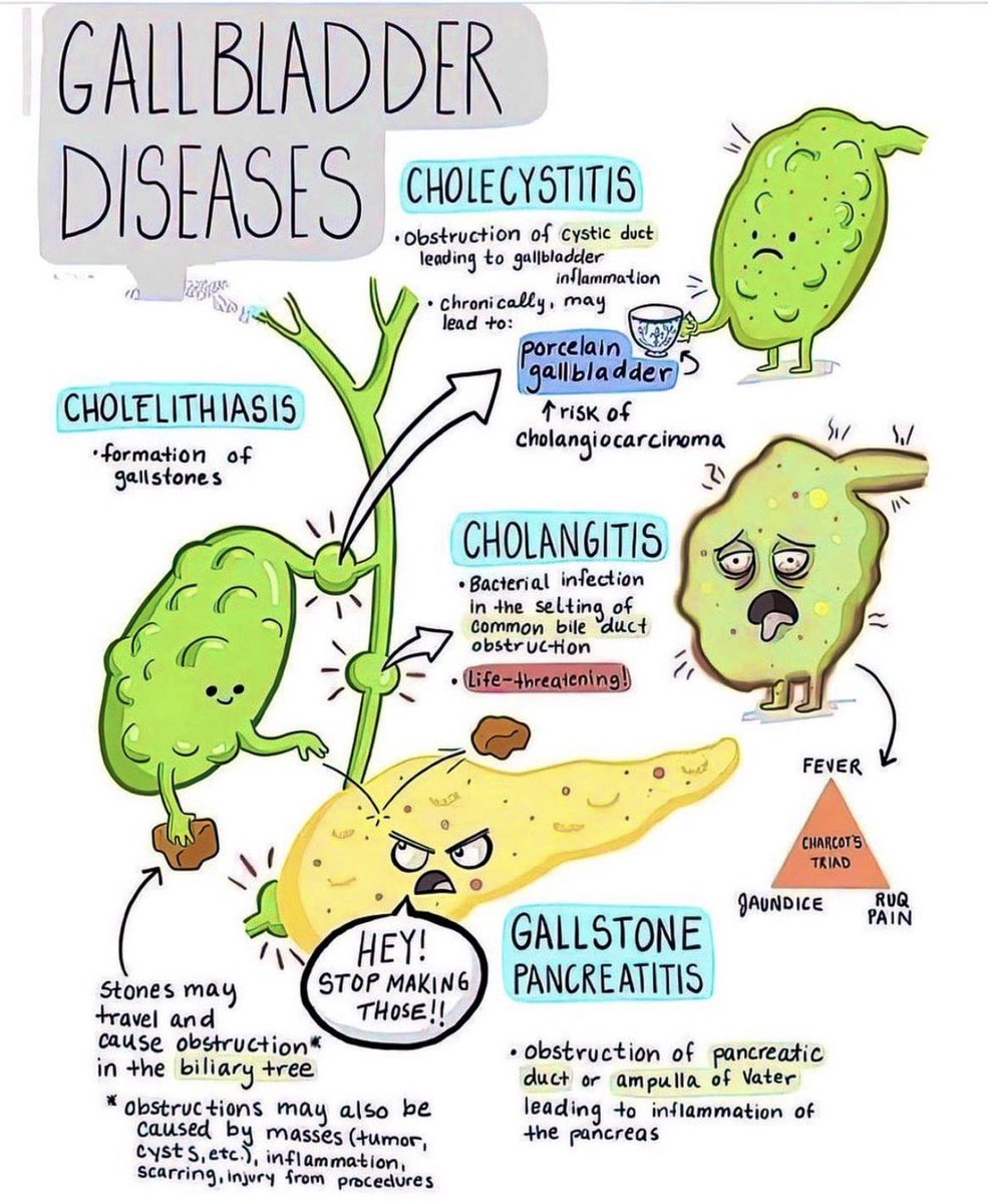 Paul_Wischmeyer's tweet photo. 📍Gallbladder diseases - simplified 
#MedEd #MedTwitter #GITwitter https://t.co/CI5Uc8b4kR
