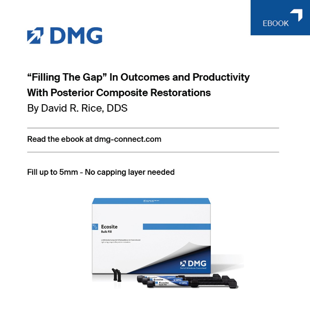 DMGAmerica's tweet photo. What makes #EcositeBulkFill the right option for dental experts like Dr. David Rice and @igniteDDS? The time savings generated by Ecosite versus the traditional multi-layer technique! The standard composite per layer saves dentists up to 110 seconds per tooth. #DMGAmerica https://t.co/35SwnShtXf