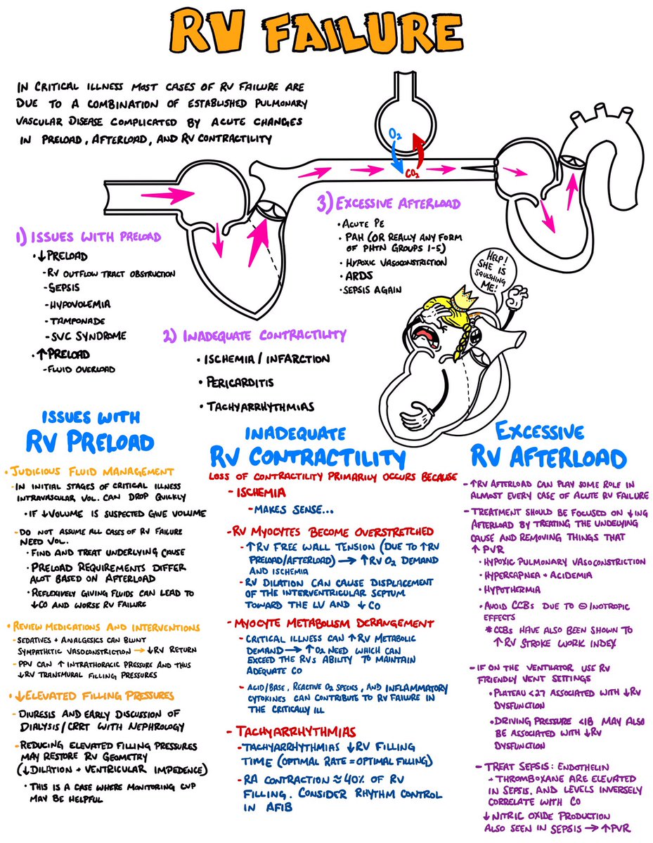 …so putting everything I need to know about #ThePeoplesVentricle on one page didn’t work out. But here’s a start! Thanks @msiuba for the article help! #MedTwitter #FOAMed #FOAMcc atsjournals.org/doi/10.1513/An… link.springer.com/article/10.100… journal.chestnet.org/article/S0012-…