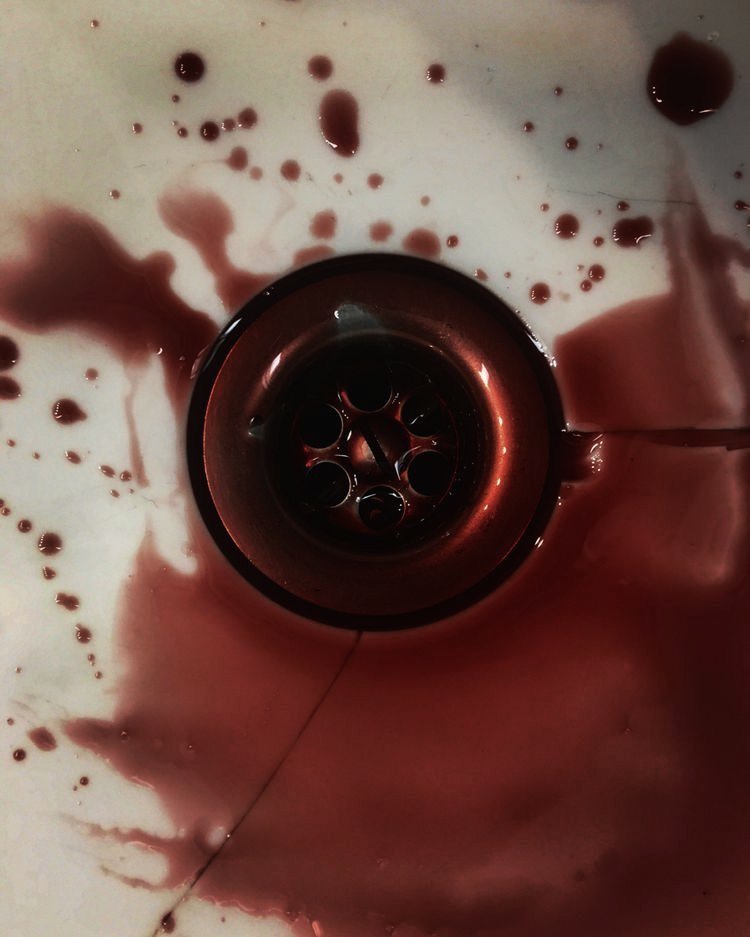 ты долженъ былъ просто сказать:
"прости меня за ​царапки​".
"прости меня за ​царапки​".
но ты ничего не сказалъ.