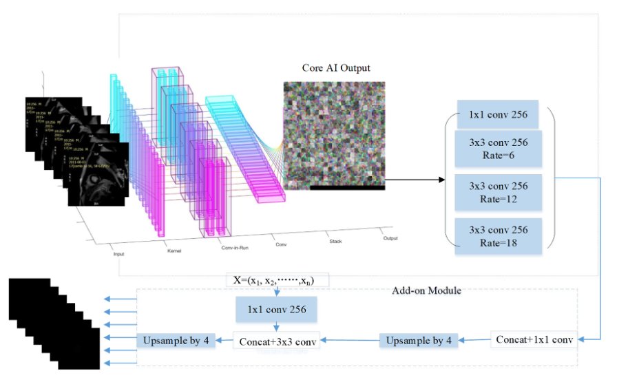Entropy_MDPI's tweet image. Read #NewPaper "MyI-Net: Fully Automatic Detection and Quantification of Myocardial Infarction from Cardiovascular MRI Images" from Shuihua Wang et al. mdpi.com/1099-4300/25/3…
#myocardialinfarction
#automaticdetection
#deeplearning
#MRI