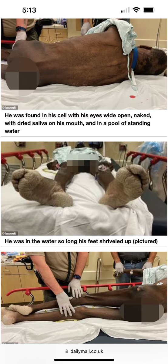 910connect's tweet image. Racist city in Arkansas let’s inmate starve to death and eat his own feces