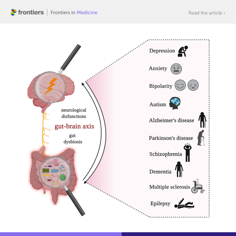 FrontiersIn's tweet photo. This study reviews recent research on the link between gut microbiota and the brain, and the microbiome’s role in shaping the development of the most common neurological and psychiatric illnesses. 

Read the study in @FrontMedicine ⬇️