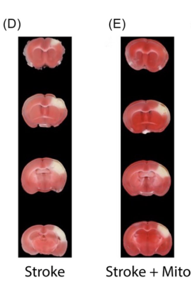 Intraarterial Transplantation of Mitochondria After Ischemic Stroke Reduces Cerebral Infarction ahajournals.org/doi/full/10.11… <a href="/SVINJournal/">Stroke: Vascular and Interventional Neurology</a> <a href="/svinsociety/">SVIN</a> <a href="/StrokeAHA_ASA/">Stroke AHA/ASA</a>