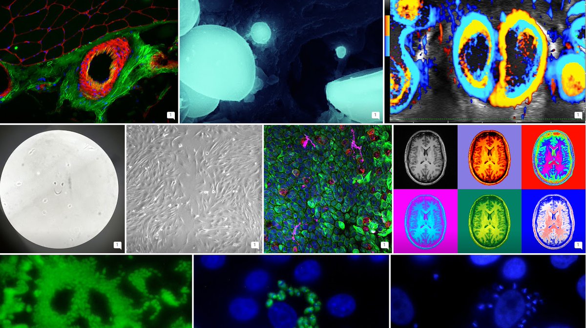The IDIBAPS 2023 Photo Contest is now open for popular voting

Every year, IDIBAPS organizes a scientific photography contest. This year around 40 images have been received. Now begins the popular vote!

👉ow.ly/694J50N6VnB
