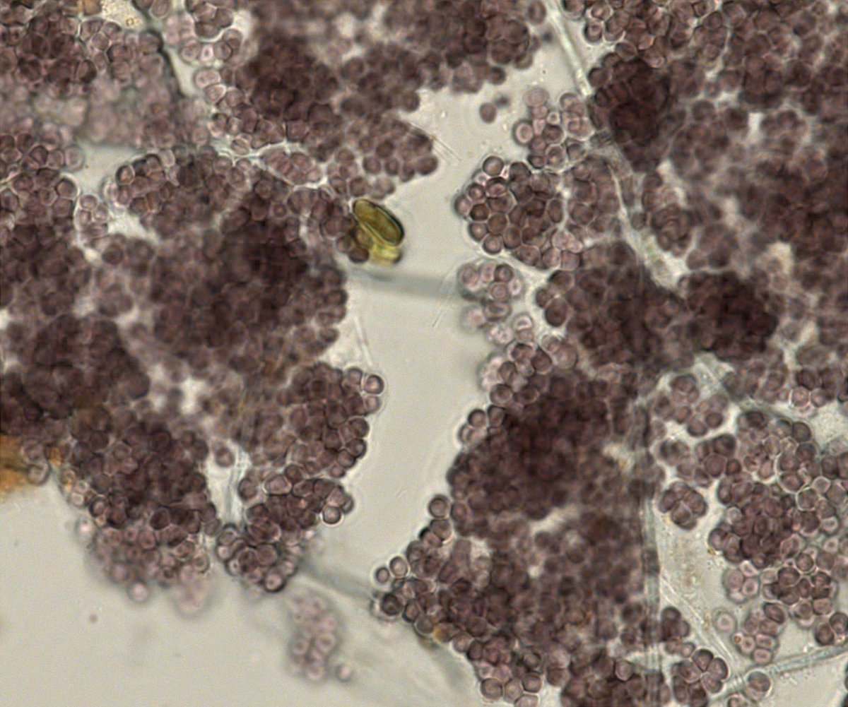CyanoBaltic's tweet photo. Did you know that cyanobacteria grow in diverse microbial communities? Check out their vibrant colors in these pictures: blackish (allophycocyanin), red (phycoerythrin), and green (phycocyanin). These pigments play important roles in photosynthesis and light adaptation! ☀️ https://t.co/fy3gNeIkeL