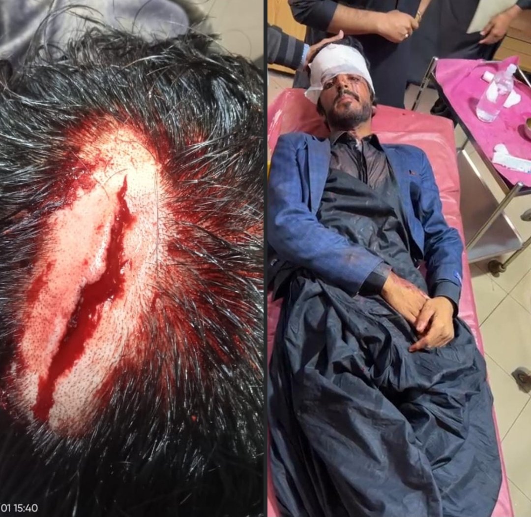 haseeb75750's tweet photo. Again the same situation,hundreds of Punjabi students attacked a Baloch student in Punjab University Lahore. 
@DrNiazAhmadSI
#quaideazamuniversity 
#savebalochstudents https://t.co/2RzzxrWgpj
