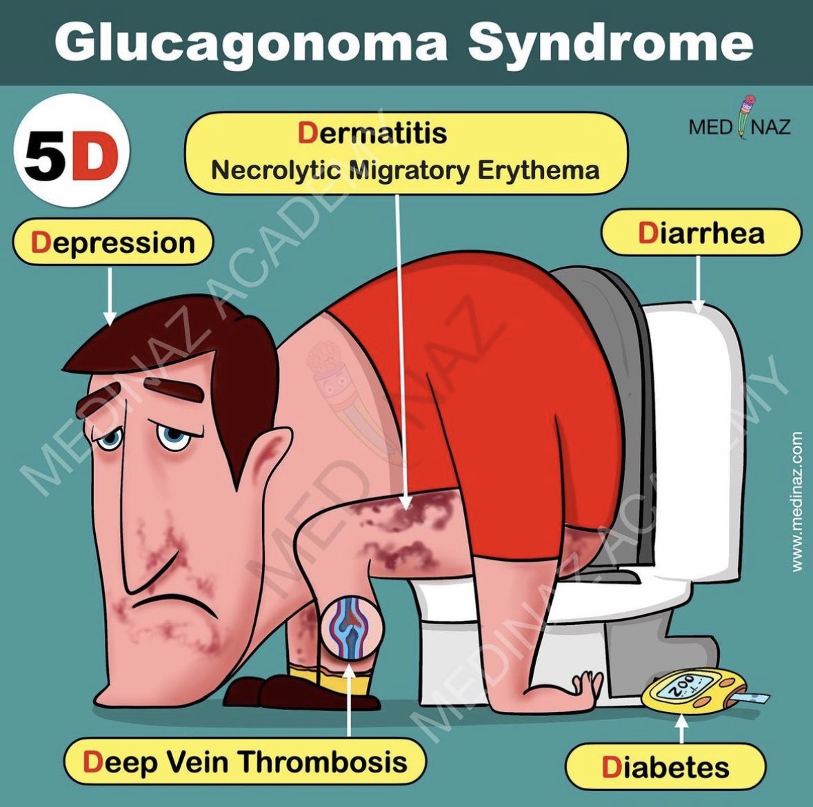 10 Symptoms of glucagonoma You Should Never Ignore