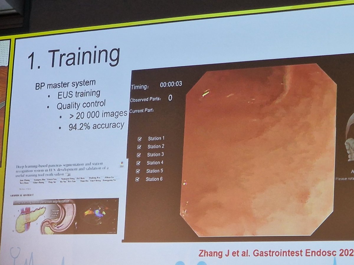 Anjum Gardezi MD (@syedgerdezi) on Twitter photo Is the future of #EUS bright or colourful?? 🎨
Artificial intelligence #AI in the #NextGenEus; a game changer?
#EuroEus2023
<a href="/SanRaffaeleMI/">Ospedale San Raffaele</a> Is the future of #EUS bright or colourful?? 🎨
Artificial intelligence #AI in the #NextGenEus; a game changer?
#EuroEus2023
<a href="/SanRaffaeleMI/">Ospedale San Raffaele</a>