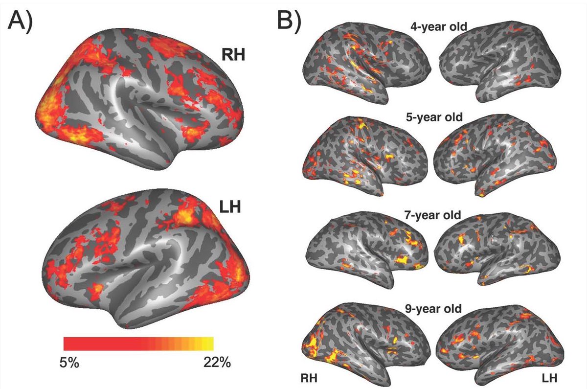 SfN Journals (@sfnjournals) on Twitter photo #JNeurosci: <a href="/elanaschettini/">Elana</a> <a href="/hiersche_kelly/">Kelly Hiersche</a> & <a href="/z_saygin/">Zeynep Saygin | zeynepsaygin.bsky.social</a> <a href="/OhioState/">Ohio State</a> show that the brain regions of the multiple demand network, recruited by adults when engaging in cognitively demanding tasks, are also selective to cognitive demand in children.
jneurosci.org/lookup/DOI/10.… #JNeurosci: <a href="/elanaschettini/">Elana</a> <a href="/hiersche_kelly/">Kelly Hiersche</a> & <a href="/z_saygin/">Zeynep Saygin | zeynepsaygin.bsky.social</a> <a href="/OhioState/">Ohio State</a> show that the brain regions of the multiple demand network, recruited by adults when engaging in cognitively demanding tasks, are also selective to cognitive demand in children.
jneurosci.org/lookup/DOI/10.…