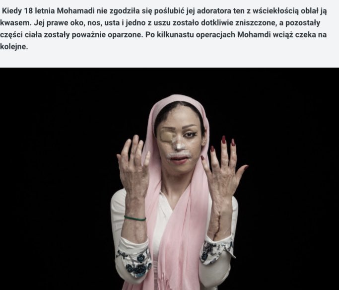 Papaweryna_'s tweet photo. 1/2 
Powodem jest krzywe spojrzenie, brak pokory, własne zdanie - to ujma na honorze i dumie mężczyzn. Indie, Bangladesz, Pakistan - kwas jest tani i zabójczo skuteczny. Ofiary do końca życia są niewidome i cierpią niewiarygodne bóle. Oszpecona kobieta zostaje sama lub z równie https://t.co/uiGCMY0CEo