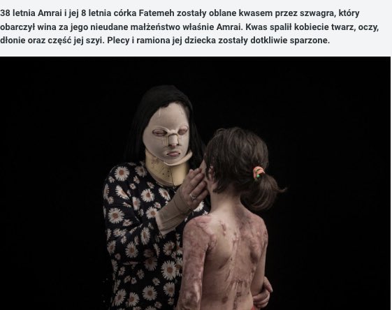 Papaweryna_'s tweet photo. 1/2 
Powodem jest krzywe spojrzenie, brak pokory, własne zdanie - to ujma na honorze i dumie mężczyzn. Indie, Bangladesz, Pakistan - kwas jest tani i zabójczo skuteczny. Ofiary do końca życia są niewidome i cierpią niewiarygodne bóle. Oszpecona kobieta zostaje sama lub z równie https://t.co/uiGCMY0CEo