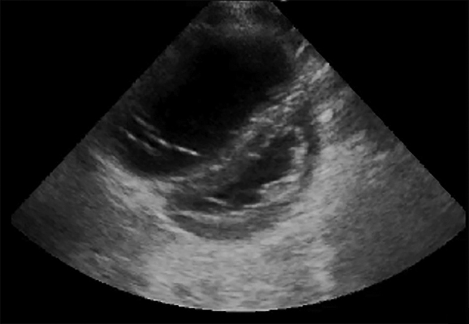 NEW GUIDELINE: Read our newest #guideline, 'Recommendations for Cardiac Point-of-Care Ultrasound in Children: A Report from the American Society of Echocardiography∗,' in our March @JournalASEcho! bit.ly/3IBt0cA