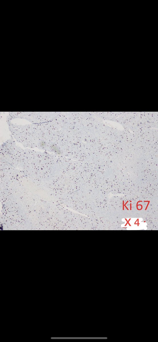 DepartmentWayne's tweet photo. Staining pattern is shown below! https://t.co/gsdwKuqAI8