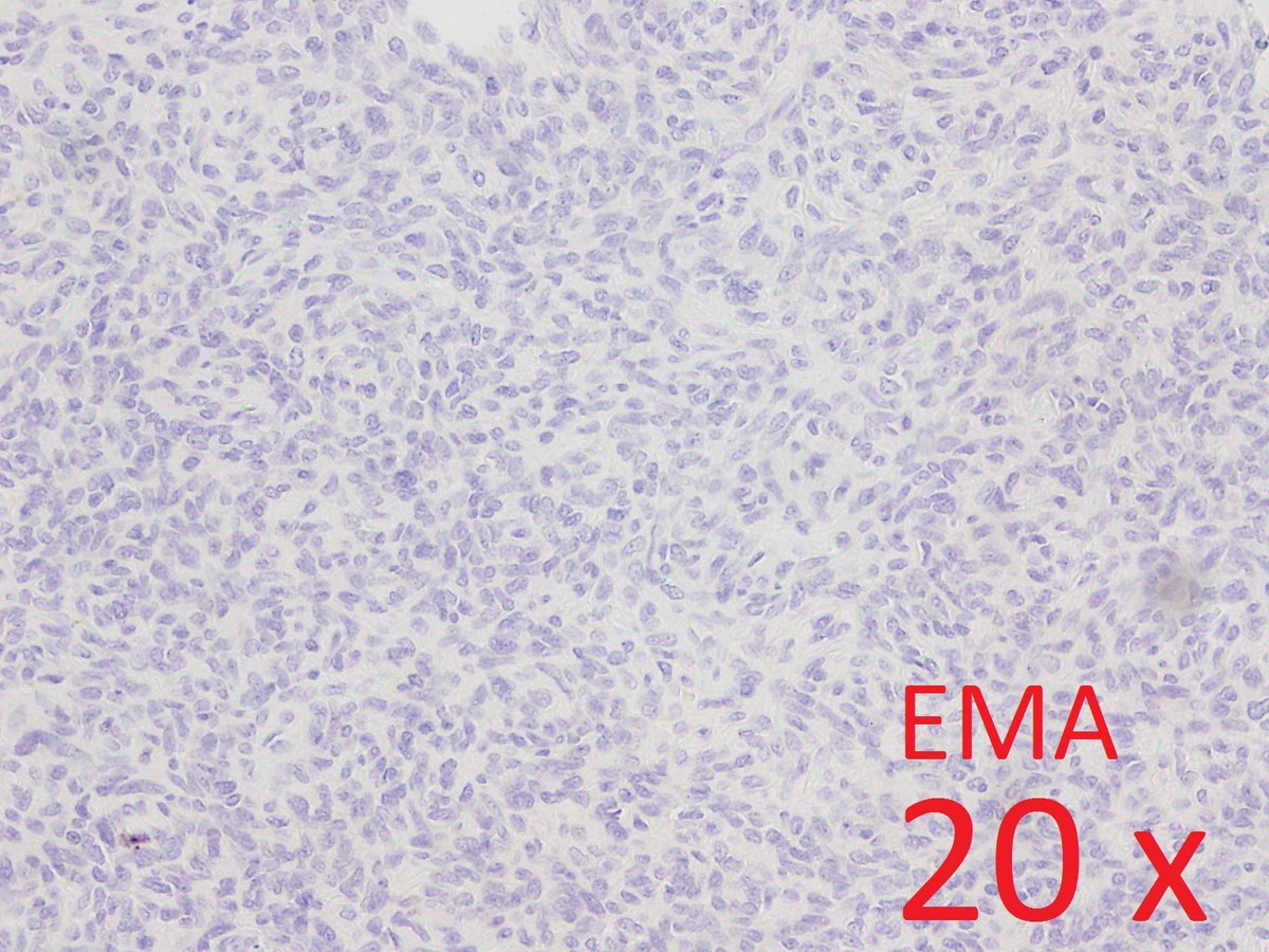 DepartmentWayne's tweet photo. Staining pattern is shown below! https://t.co/gsdwKuqAI8