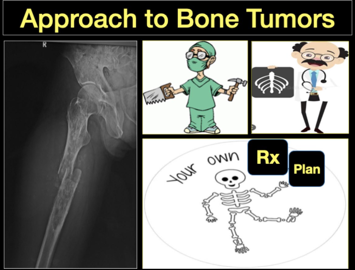 bonestumor's tweet photo. *An exclusive session on โTips and Tricks of Bone Biopsyโ on 2nd March 2023, 3:00 PM IST*
onwards.https://t.co/6KoGiXMx72 #orthopaedics #orthotwitter #MedTwitter #sarcoma #sarcomaawarness #surgery #oncology #webinar #bonebiopsy https://t.co/iquRdetYB5
