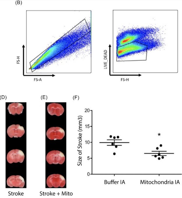 Intra-arterial delivery of #mitochondria reduces #stroke size.. amazing feeling seeing this work not only published but result in clinical trial - doi.org/10.1161/SVIN.1… - clinicaltrials.gov/ct2/show/NCT04… <a href="/svinsociety/">SVIN</a> <a href="/SVINJournal/">Stroke: Vascular and Interventional Neurology</a> <a href="/cvsection/">CV Section</a> <a href="/StrokeAHA_ASA/">Stroke AHA/ASA</a>
