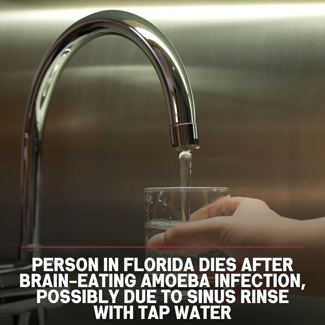 WSVN 7 News on Twitter "BRAINEATING AMOEBA A person in Southwest