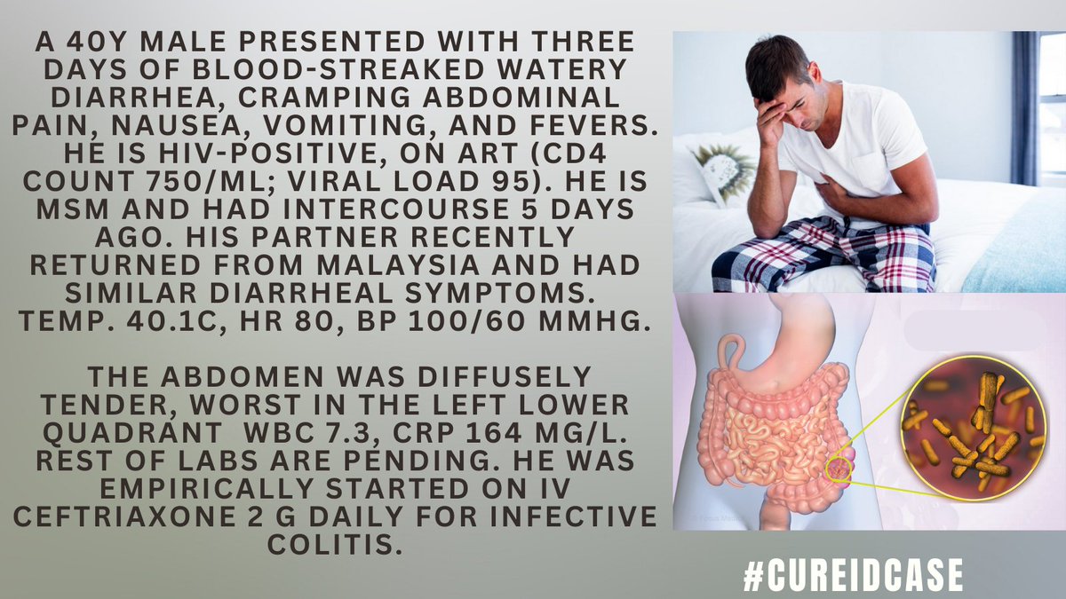 id_cure's tweet photo. #CUREIDCase 
Find more details that will help you make the correct diagnosis on CURE ID: https://t.co/uUf6O7FDFc
#IDTwitter #IDMedEd #MedEd #IDCase #CUREID
Which of the following is the most likely cause of the patient’s illness: 
Shigellosis
Salmonella
CMV Colitis
Campylobacter https://t.co/bt94h5Ylj3