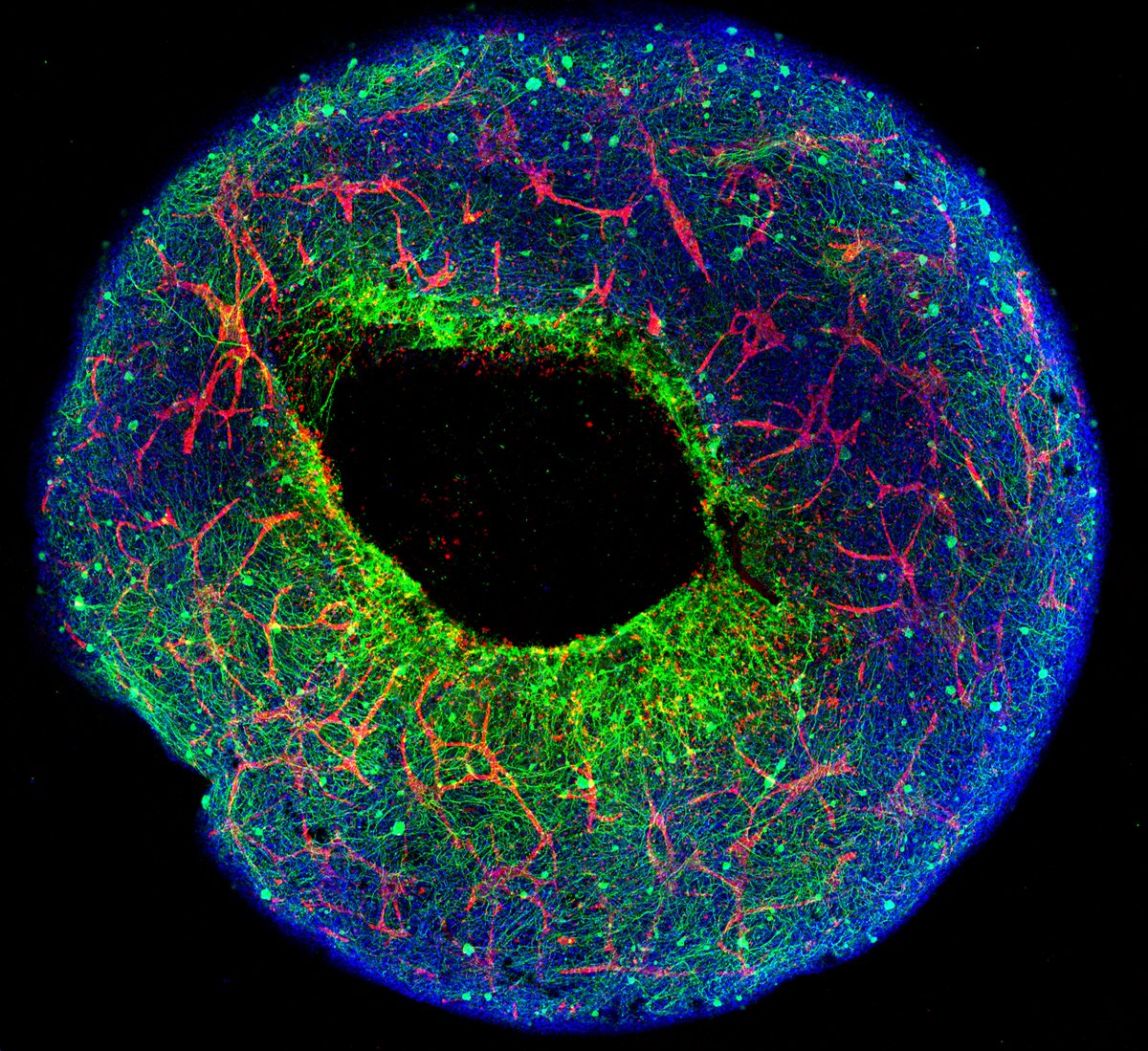Mix together stem cell-derived neurons 💚, vascular ❤️&amp; other brain cells 💙, allow them to self-assemble into droplet size 3D human brain 👉 WHAAAAT?! Louise Louro’s BEAUTIFUL IMAGE “The Brain Donut” is EXTRAORDINARY SCIENCE! VOTE #ArtoftheBrain #CallforImages #20 Most🧡s wins!