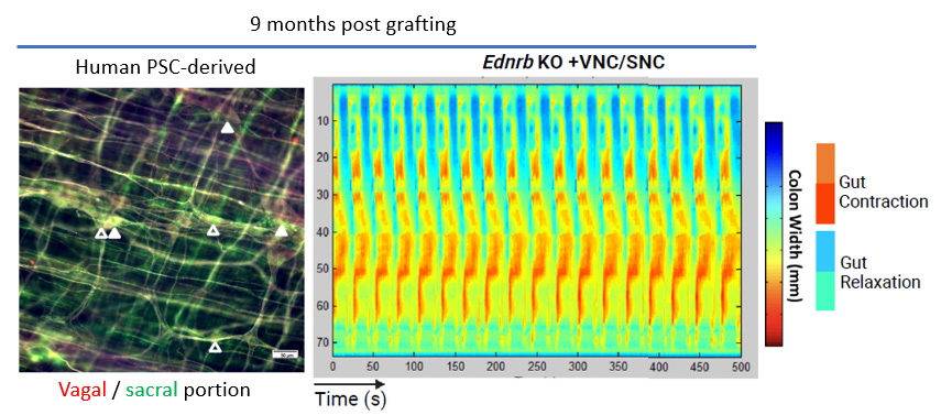 In vivo gut motility controlled by grafted human PSC-derived ENS in severe mouse model of Hirschsprung’s disease. Study now published @CellStemCell on sacral-derived ENS precursors bit.ly/3J8EoOA. Huge effort by Yujie Fan and an amazing team of collaborators @MSK_CSCB