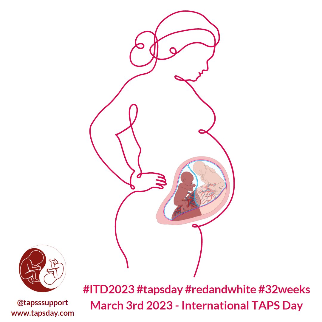 It’s important that treatment options are discussed with families, & that care professionals take the time to explain the options, & develop a care plan with families. More: bit.ly/3ovBIjL #32weeks #redandwhite #tapsday #itd2023 #showyourcolors #tapstwins @tapssupport