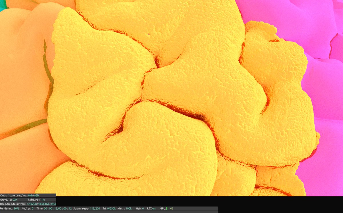 amyneurons's tweet photo. #popquiz what part of the brain is this? https://t.co/t8ipg4fSke