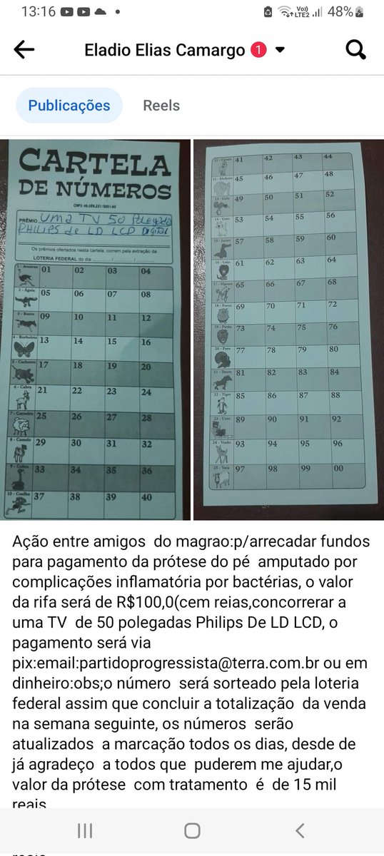 Patriotas estou precisando  da ajuda,para conseguir colocar minha prótese  no pé, doação de qualquer  valor via pix:tel:11-93775-5882