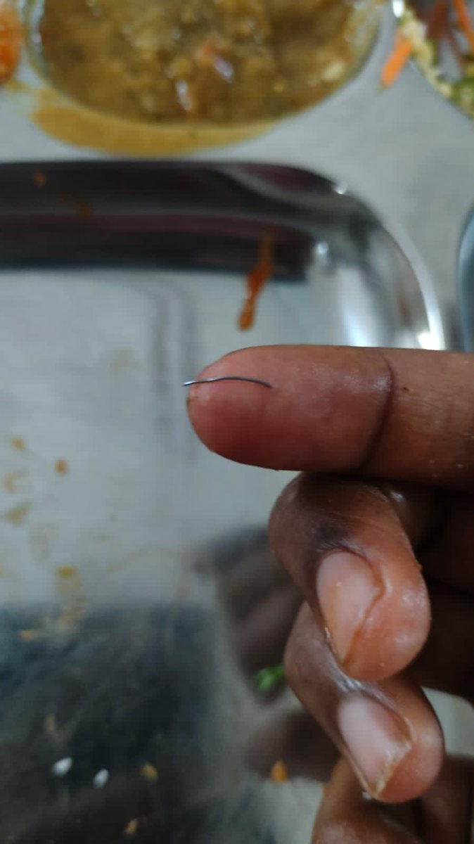 MIT_B_MAHE's tweet photo. Insects in MIT B hostel mess food is now common. The new nutrition added is -Metal wire in the food. Kids iron deficiency may get better?! Jokes aside - insects metal wire in food is a punishable offense. No official warden is bothered to take action. 
@MIT_MANIPAL
@manipalblog https://t.co/dtXKLMdBPi