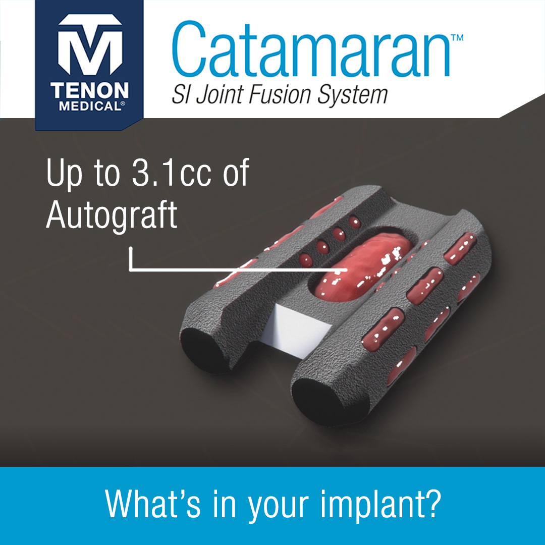 “Instrumentation of a large joint without placement of appropriate bony substrate is likely to result in pseudoarthrosis and failure.” (AANS/CNS Letter on SI Joint Fusion 061121) How much graft does your SI Joint Fusion System hold? Learn more: hubs.ly/Q01C0x090